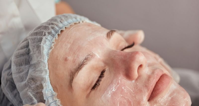 ISEIE-Máster en Tratamiento del Acné