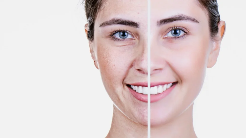 Máster en Dermatología y Antiaging Master en Dermatología y Antiaging