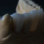 Curso en Odontología Forense