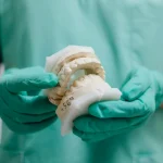 ISEE, CURSOS ONLINE- Diplomado en Diseño de Prótesis Removibles Avanzadas