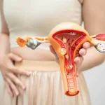 Máster en Ciclo Menstrual y Endocrinología Reproductiva 1