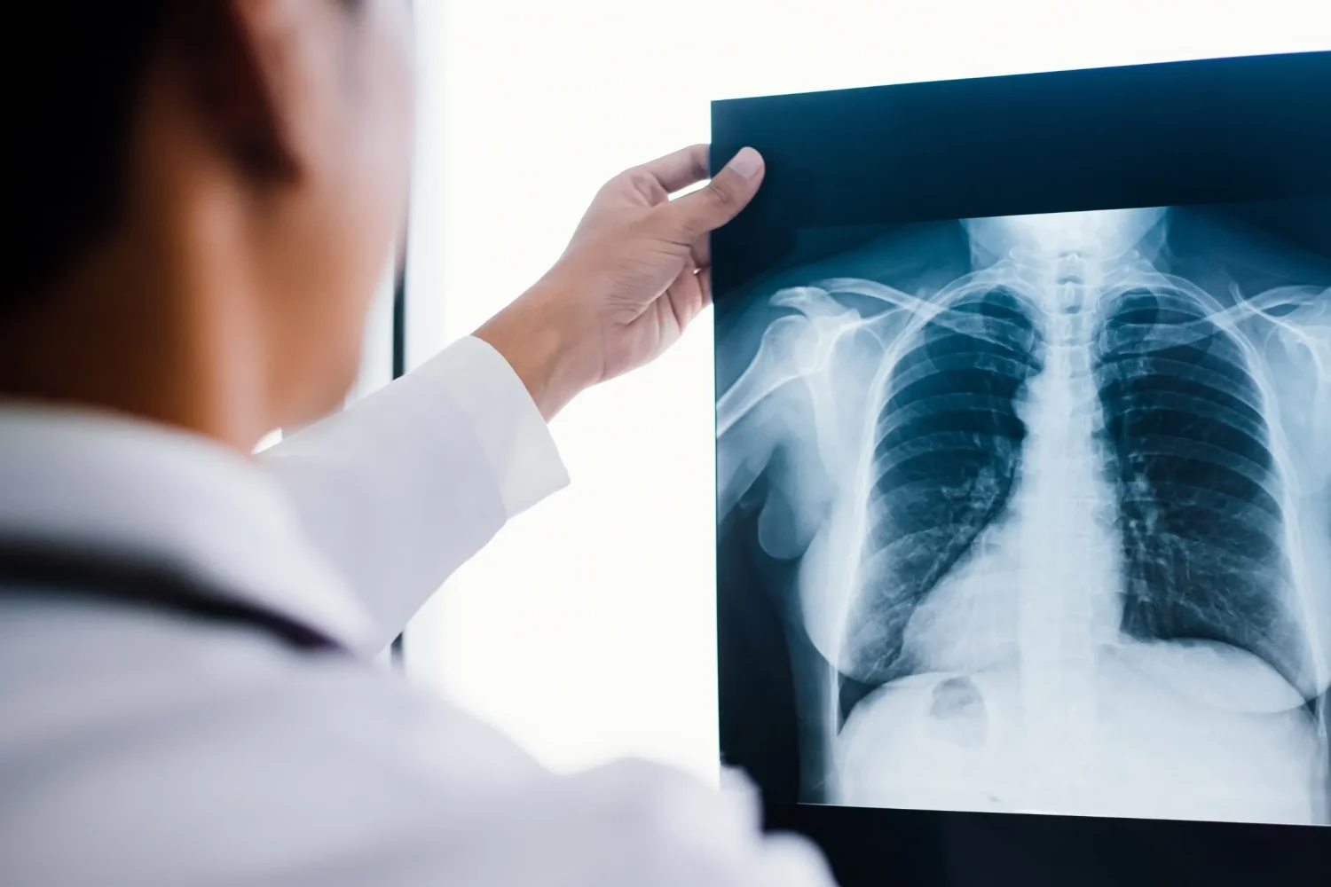 Máster en Oncología Torácica 2